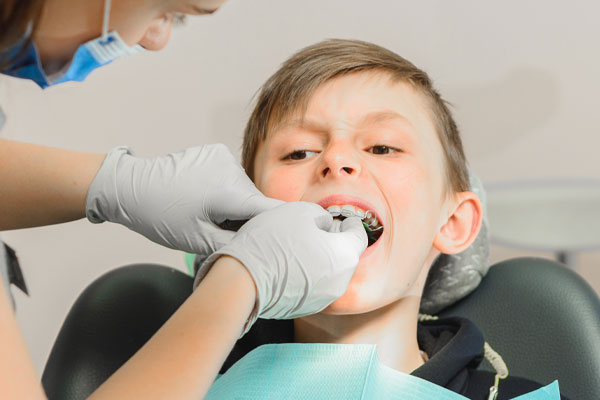 Learn more about orthodontic appliances