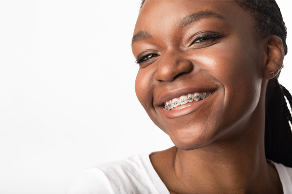 Discover the types of braces at Warsaw Orthodontics
