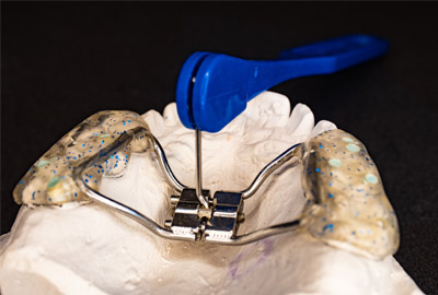 Learn more about orthodontic appliances